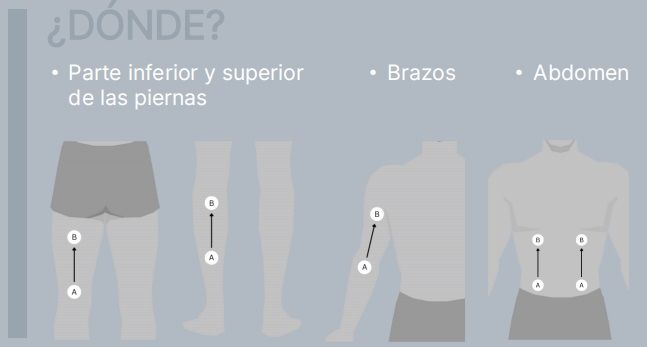 Movimientos tratamiento Restaurar